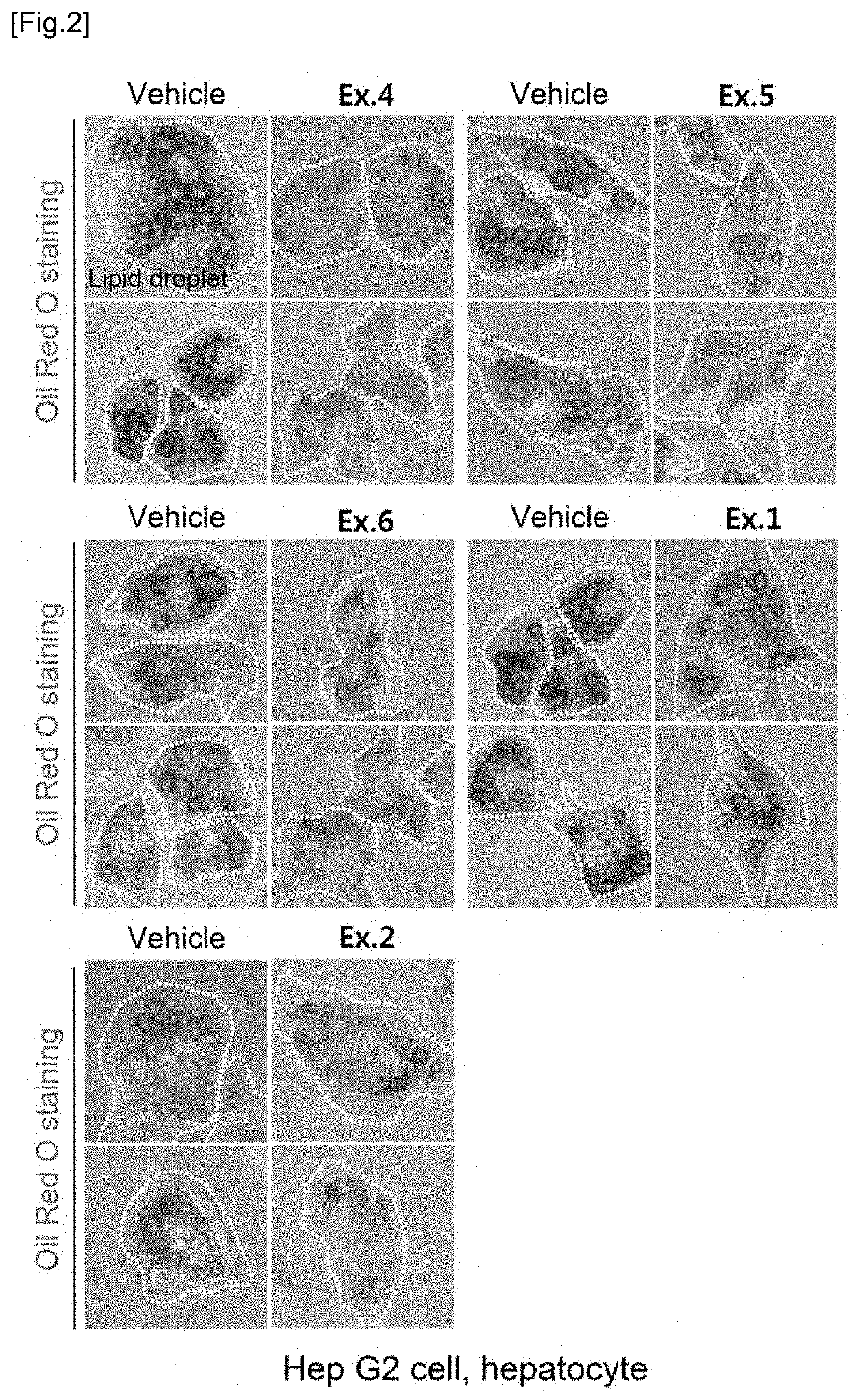 Novel compound and pharmacetical composition for preventing or treating obesity or metabolic syndrome comprising thereof