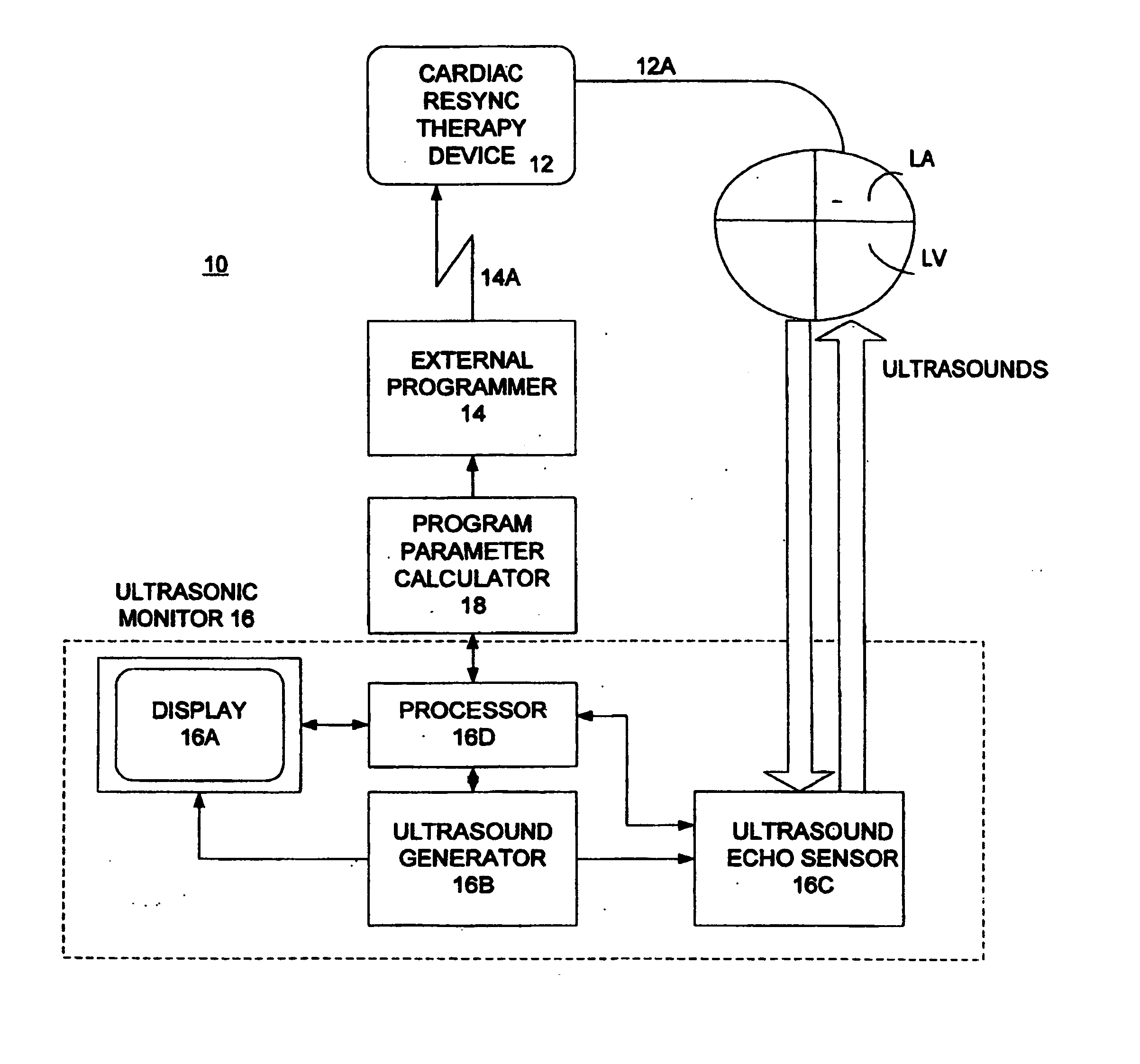 Optimization of impedance signals for closed loop programming of cardiac resynchronization therapy devices