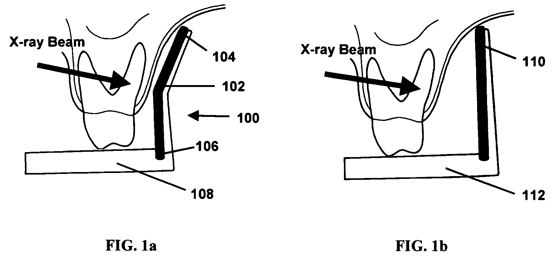 Anatomically conforming intraoral dental radiographic sensor