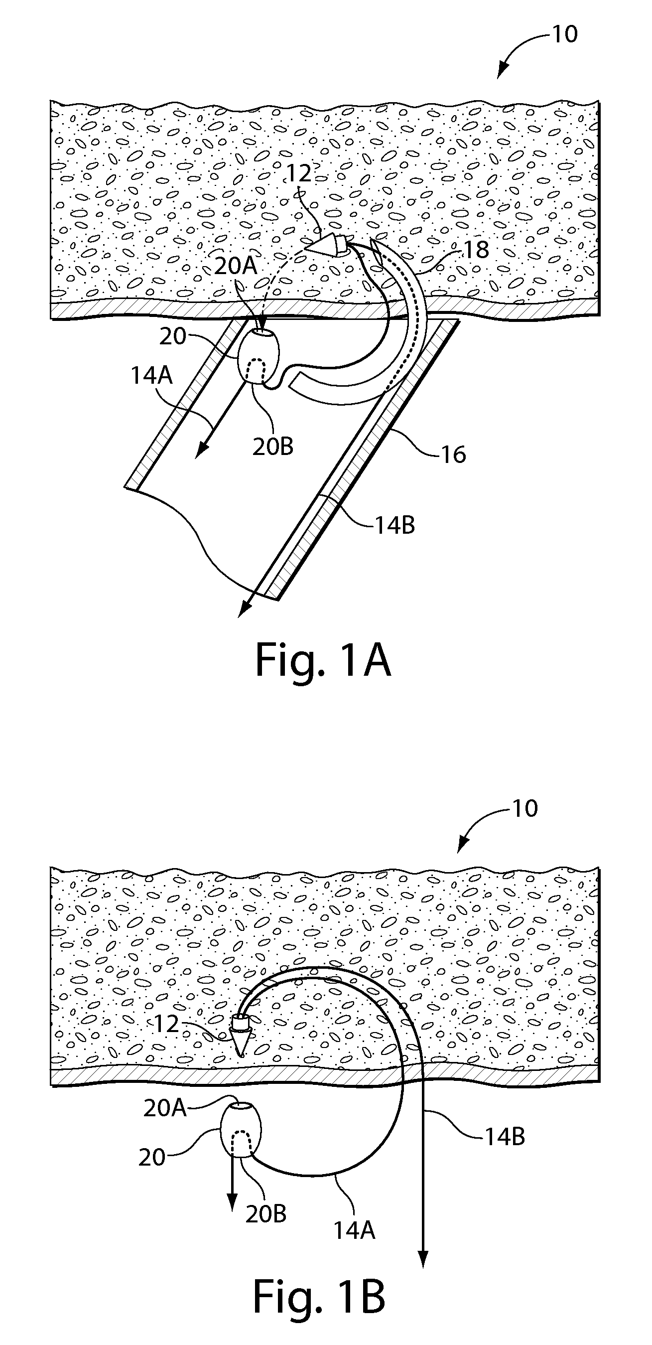 Systems and methods for soft tissue reconstruction