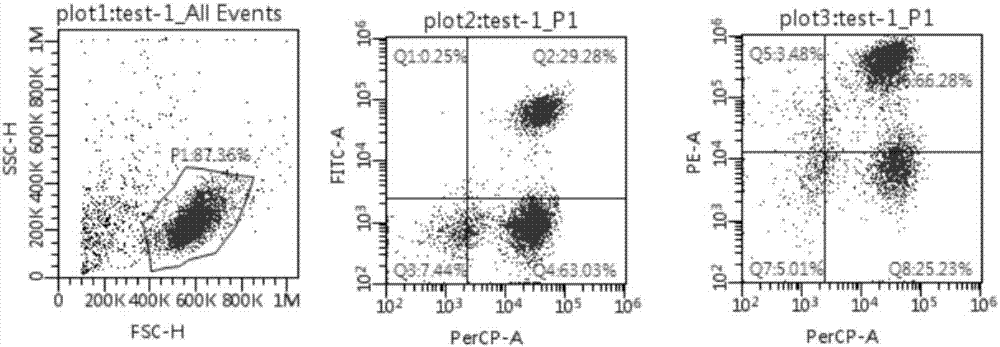 Tumor tissue tumor infiltrating lymphocyte (TIL) cell preparation method and dedicated culture medium