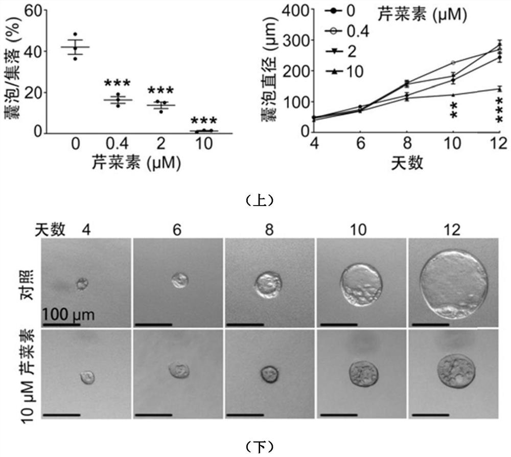 Application of apigenin in preparation of medicine for treating and/or preventing autosomal dominant hereditary polycystic kidney disease