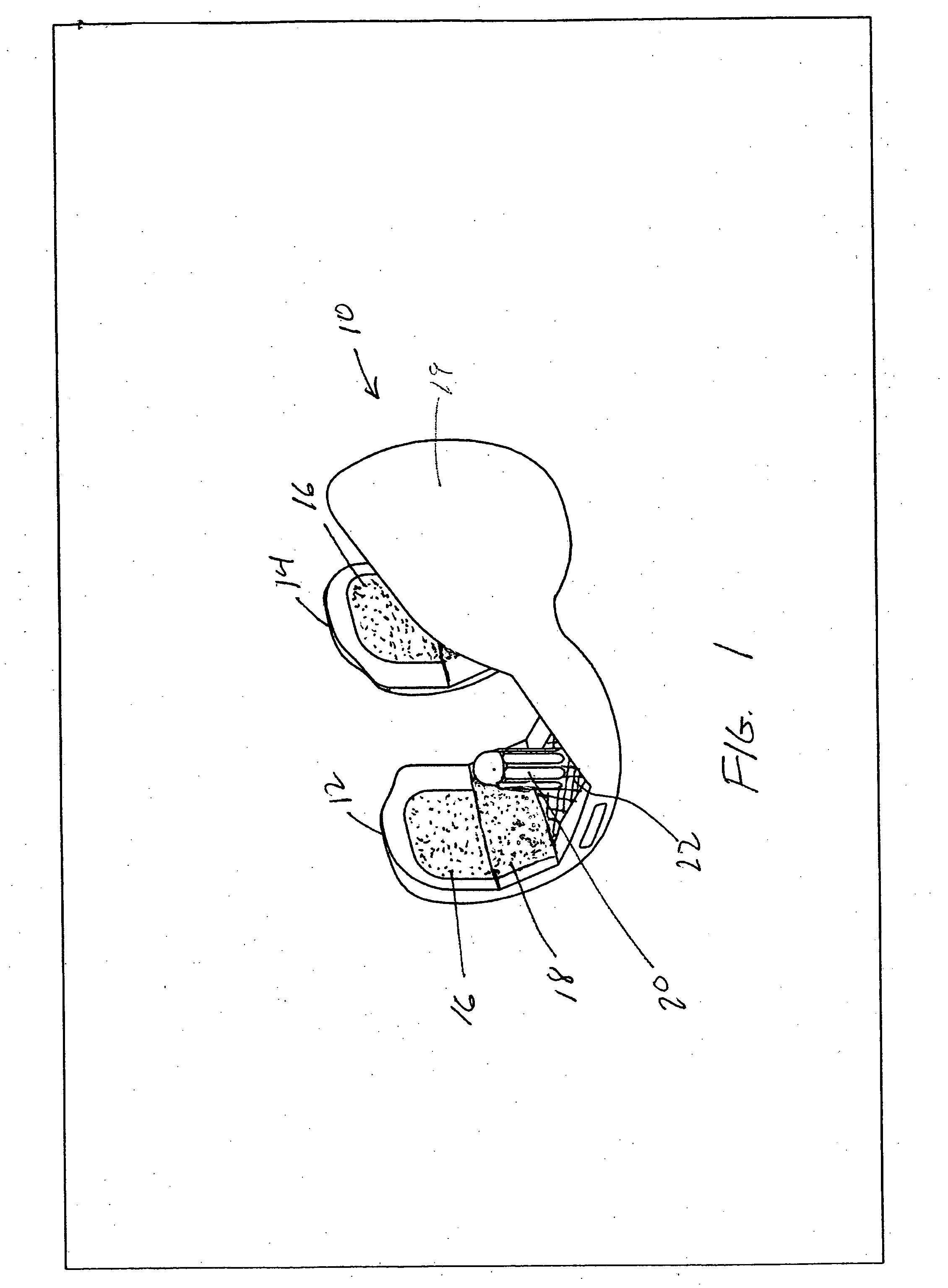 Hybrid femoral implant