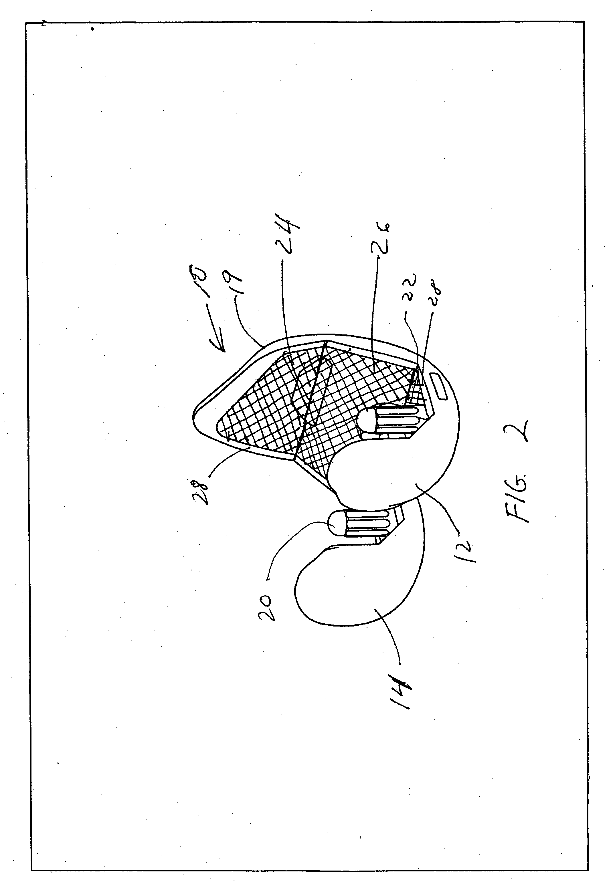 Hybrid femoral implant