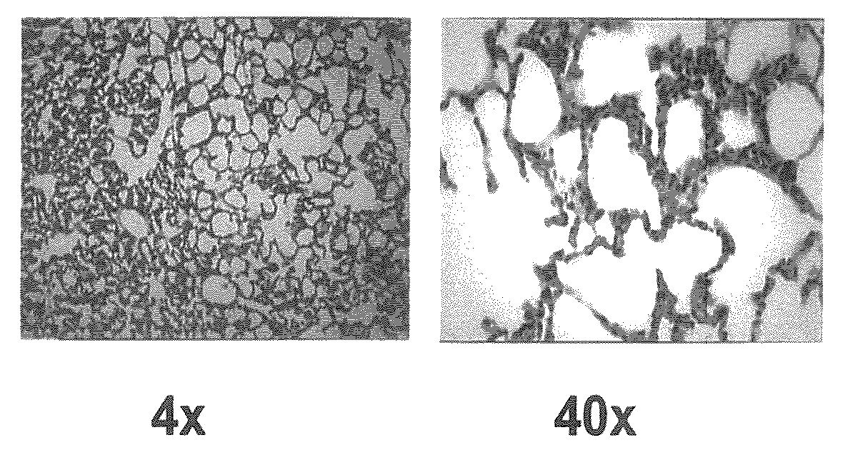 Albumin-based colloid composition and method of use in treating hypovolemia and multiorgan dysfunction