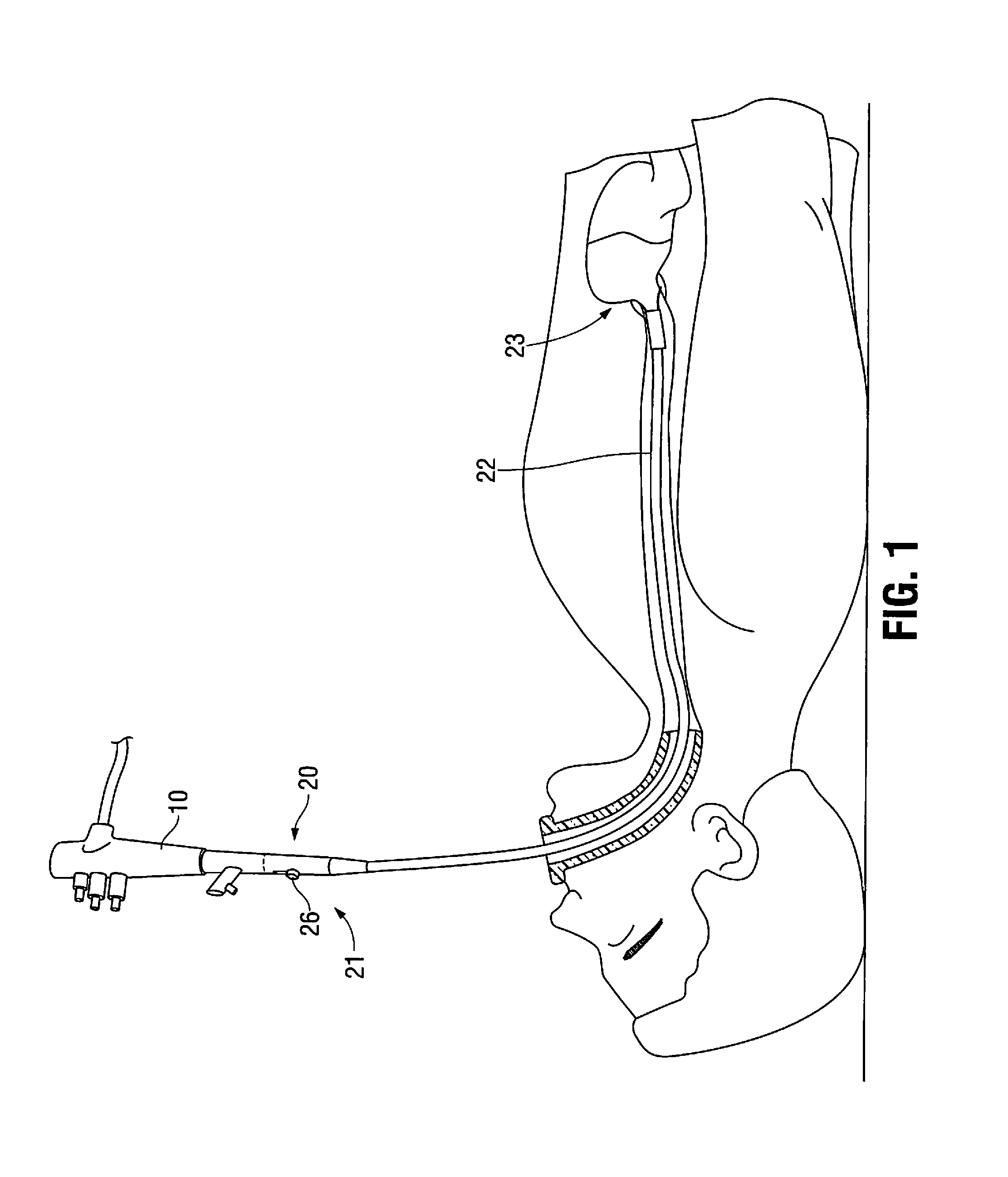 Systems and methods for treating tissue with radiofrequency energy