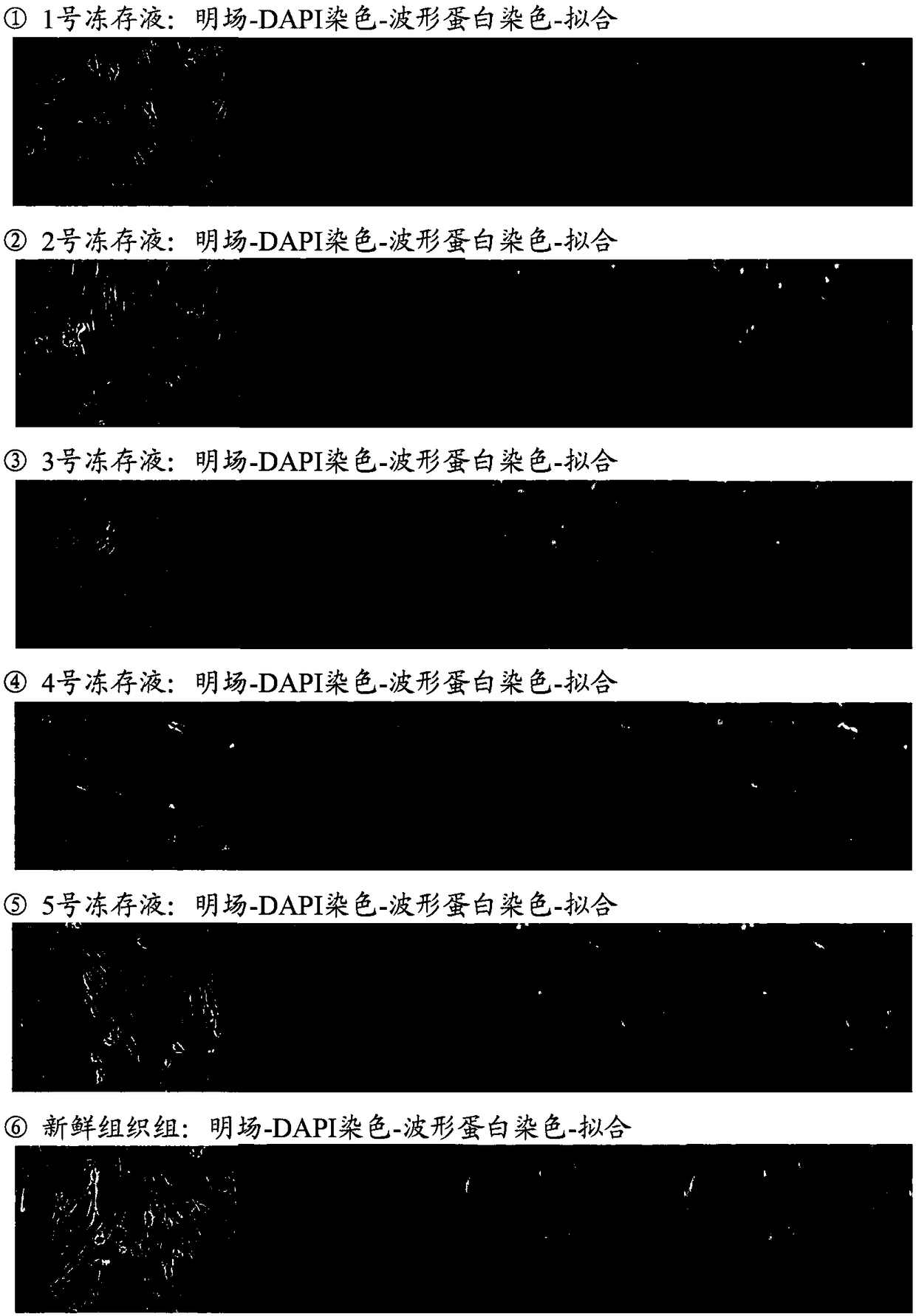 Tissue and/or cell cryopreservation protective solution as well as preparation and application thereof