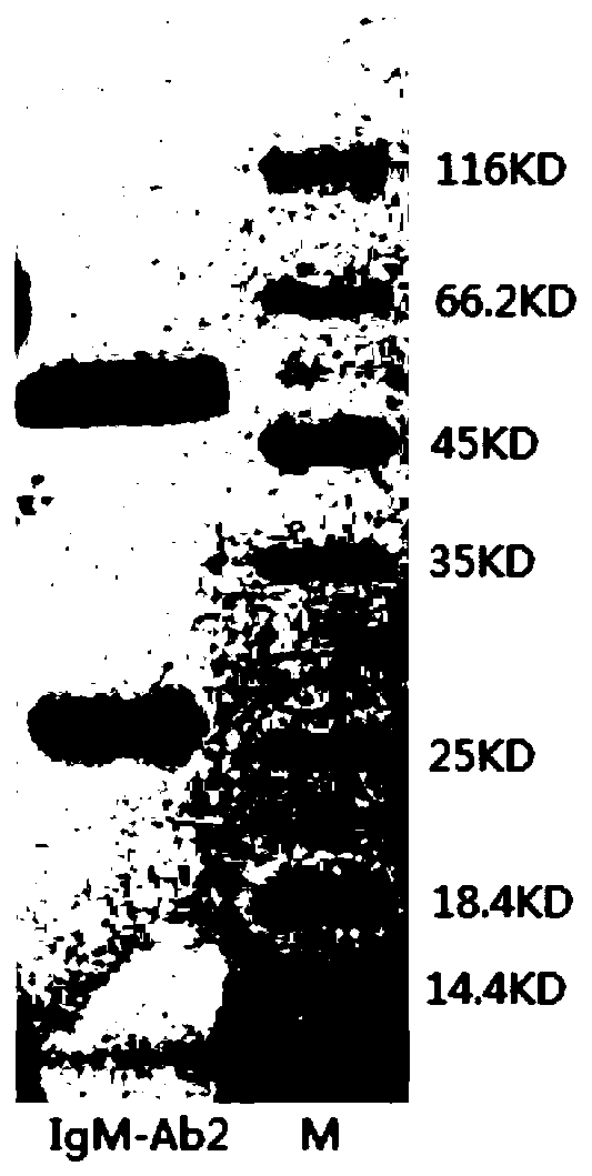 Anti-human igm monoclonal antibody, its hybridoma cell line and application