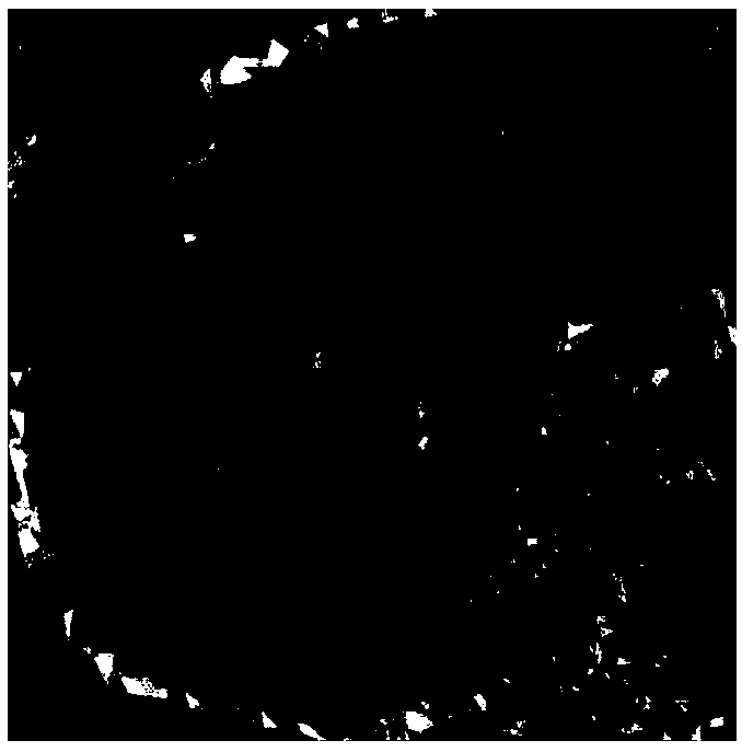 A prefabrication method of titanium mesh for orbital wall blowout fracture