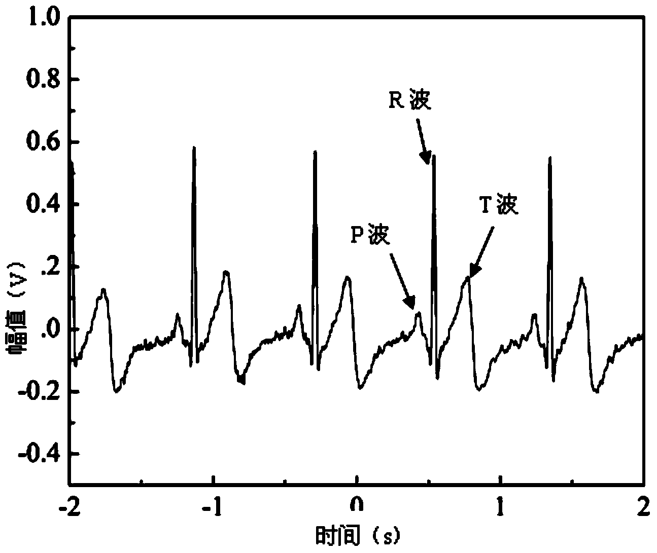 Preparation method of spinning electrode used for testing electrocardiosignal