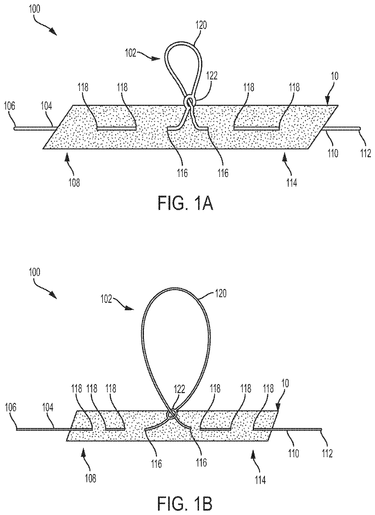 Anchored loop-in-loop suture anchor