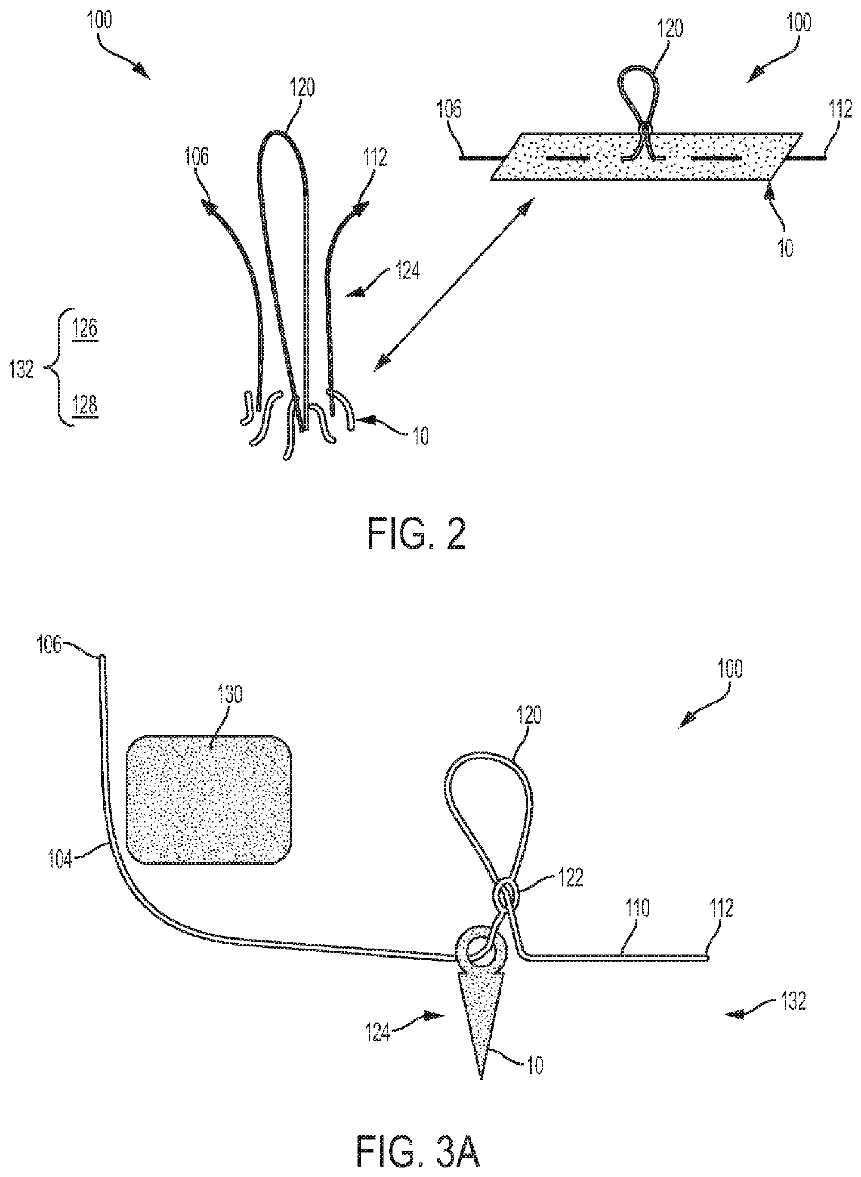 Anchored loop-in-loop suture anchor