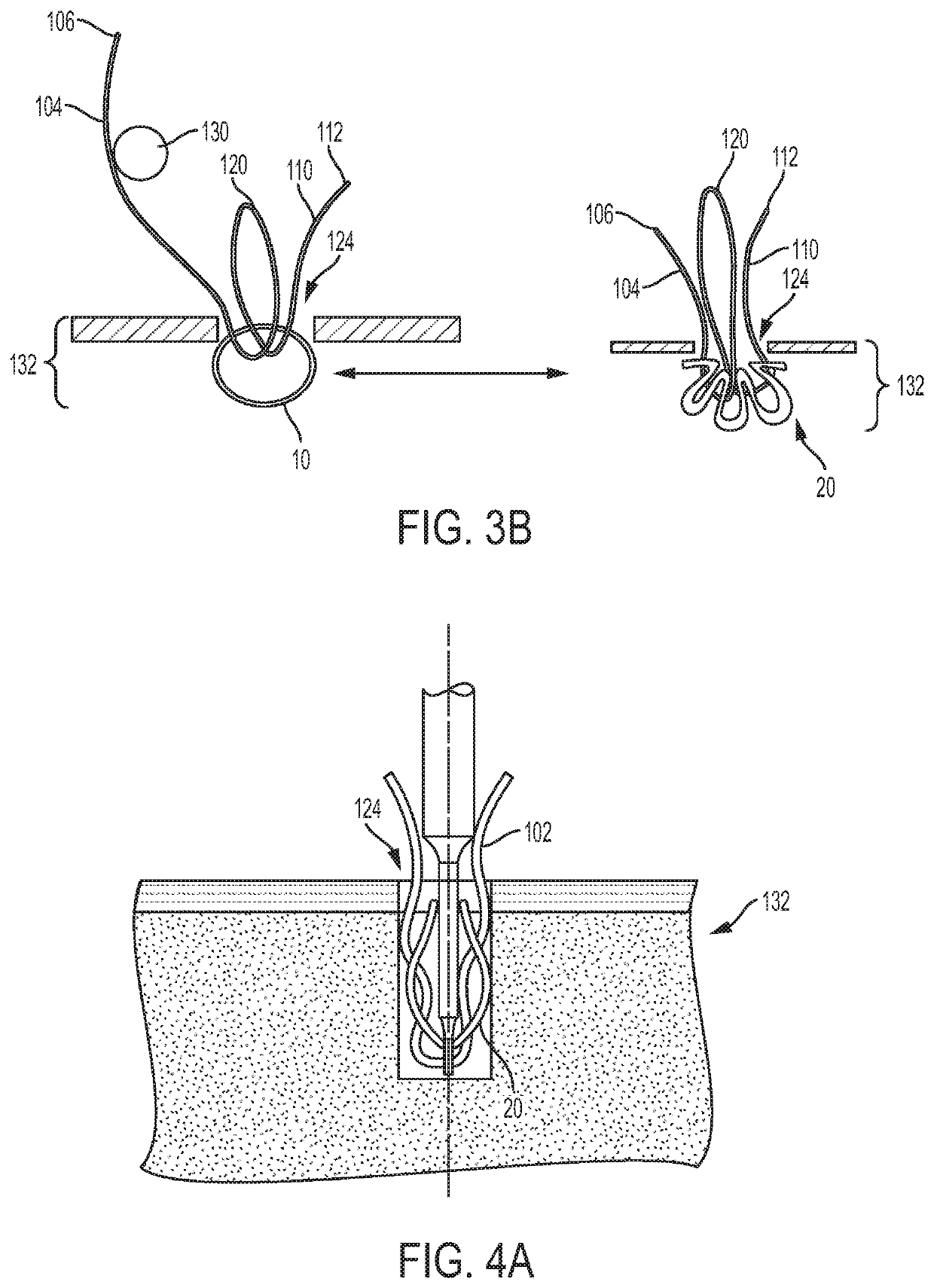 Anchored loop-in-loop suture anchor