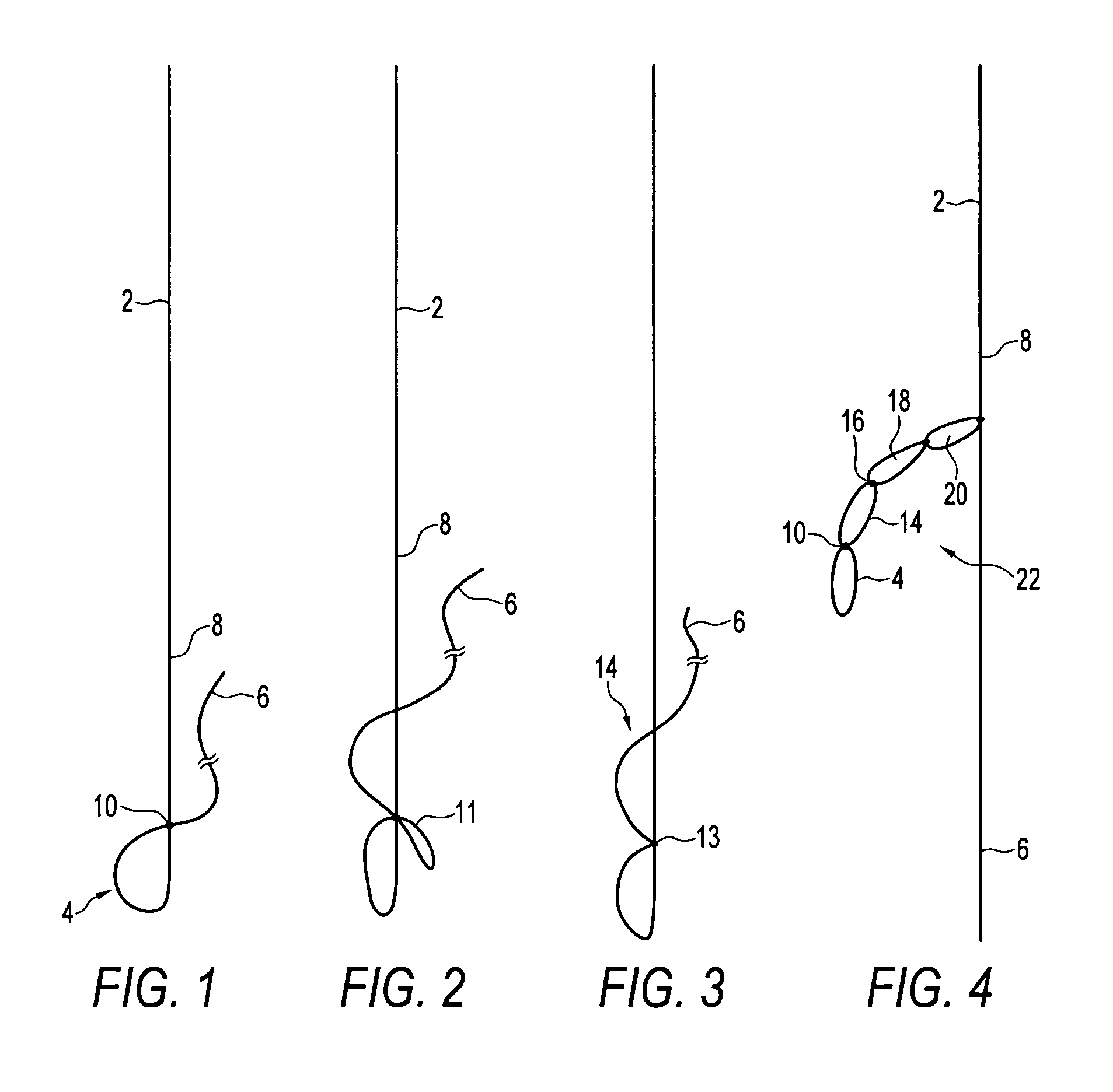 Looped high strength suture chain for knotless fixation