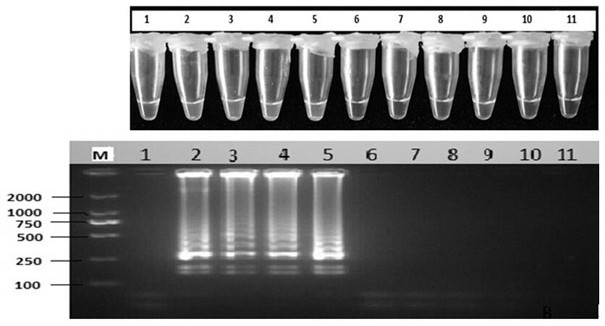 A kind of detection primer of potato infestans lamp and its visual detection method