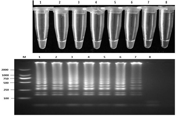 A kind of detection primer of potato infestans lamp and its visual detection method