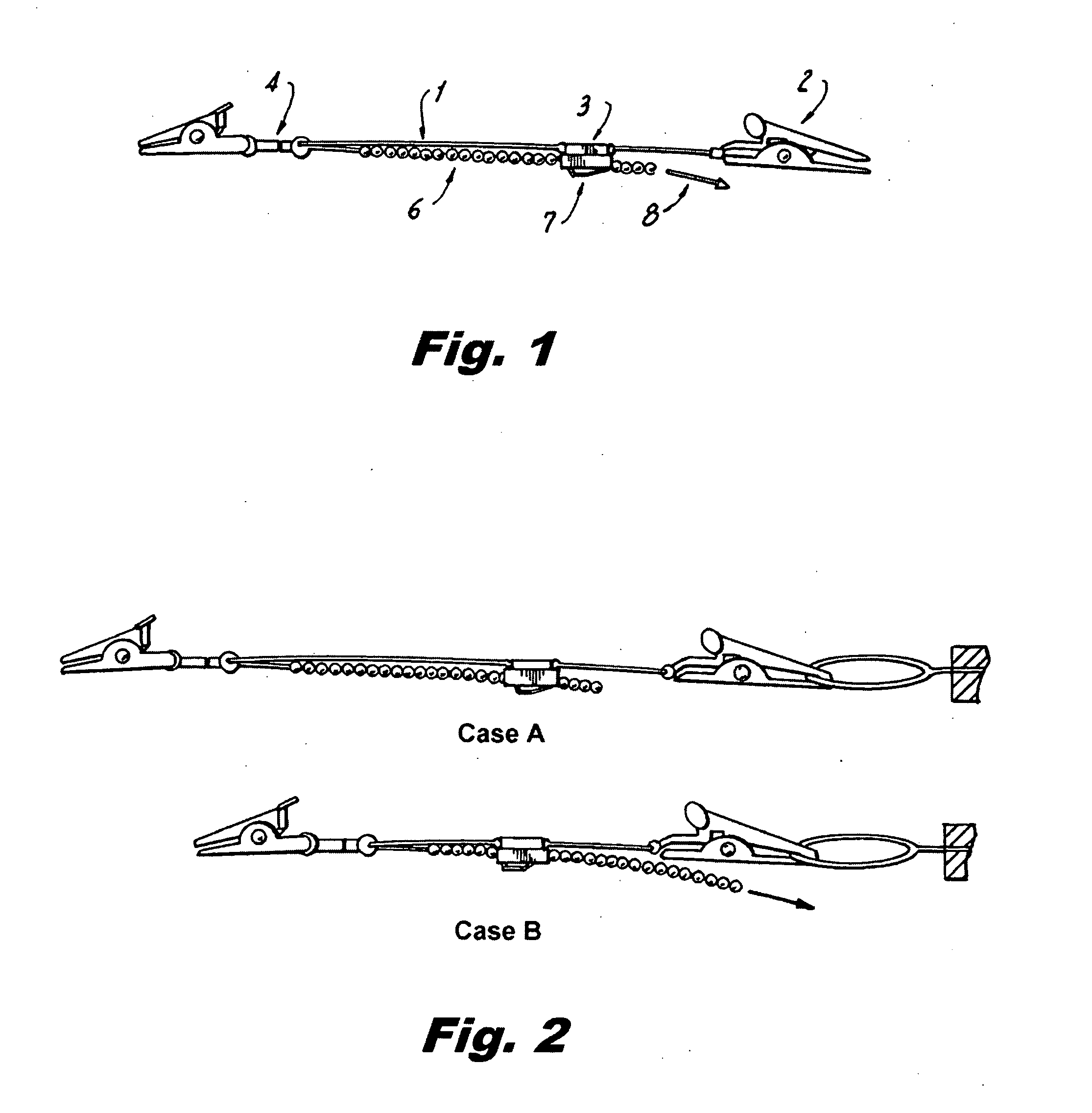 Internal Retraction Systems and Devices