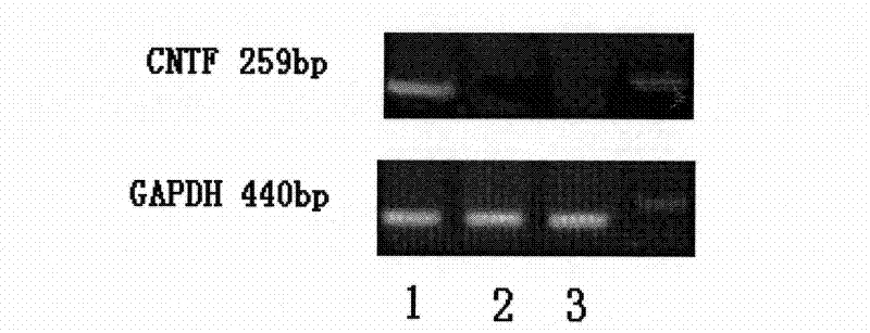 Tissue engineered artificial optic nerve conduit and preparation method thereof