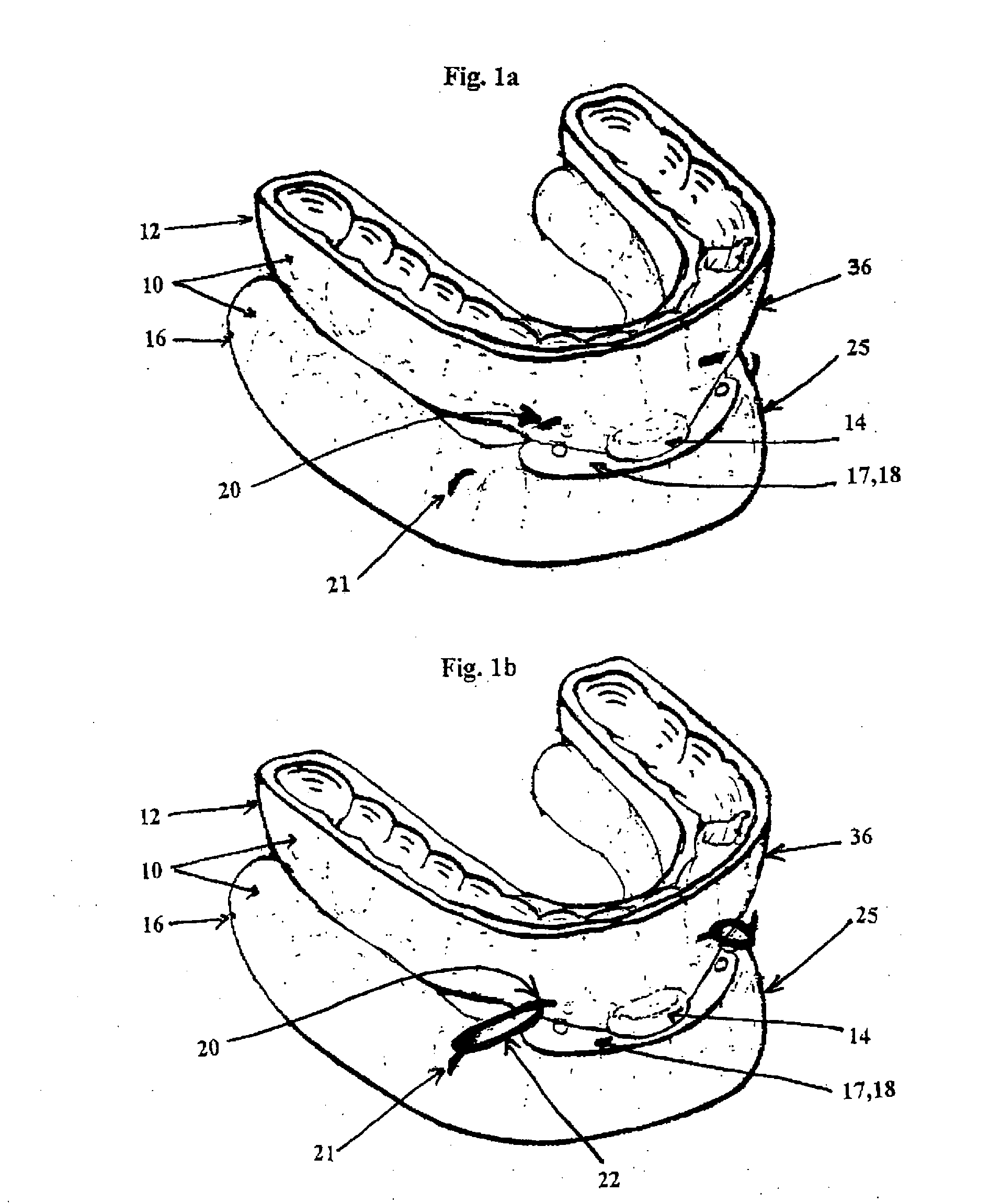 Magnetic dental appliance