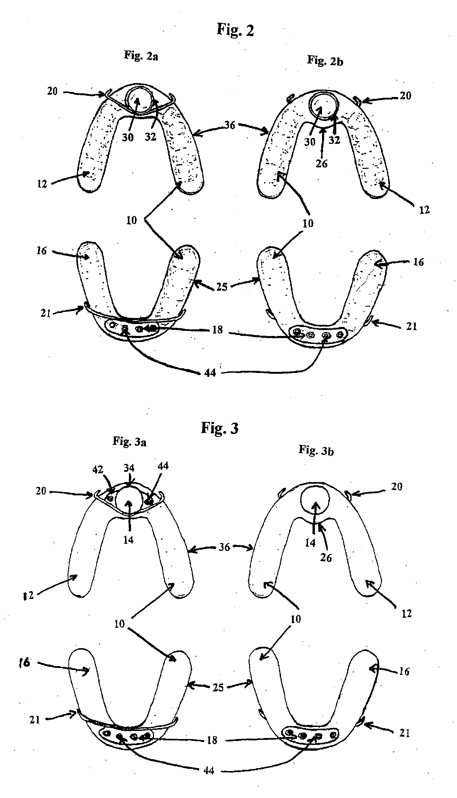 Magnetic dental appliance