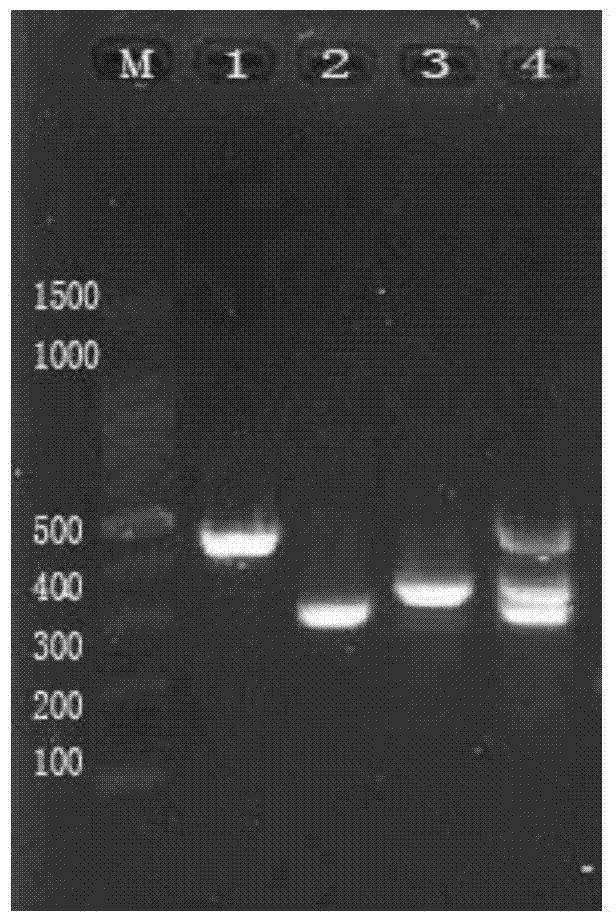 Gene chip and kit for detecting Newcastle disease virus, avian infectious bronchitis virus and avian infectious laryngotracheitis virus