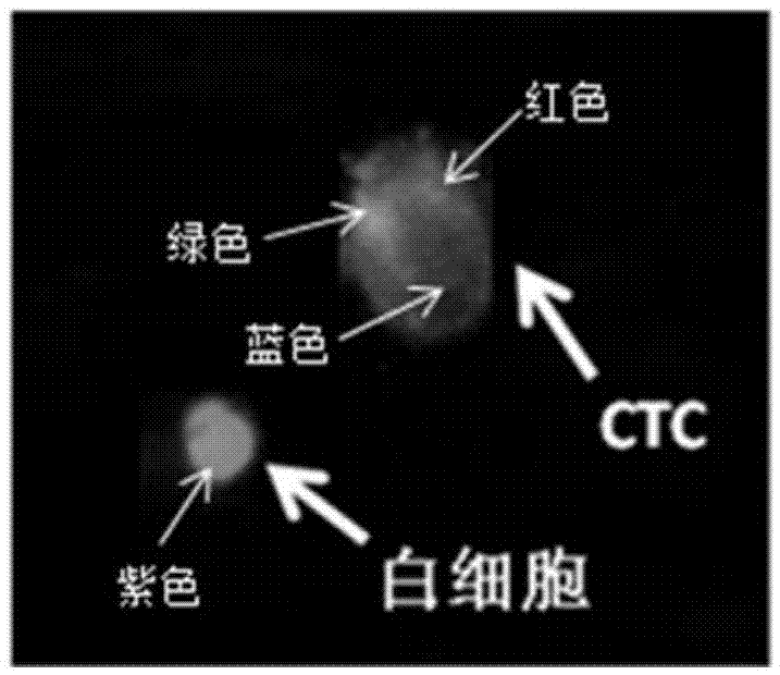 Microfluidic-technology-based CTC protein typing kit