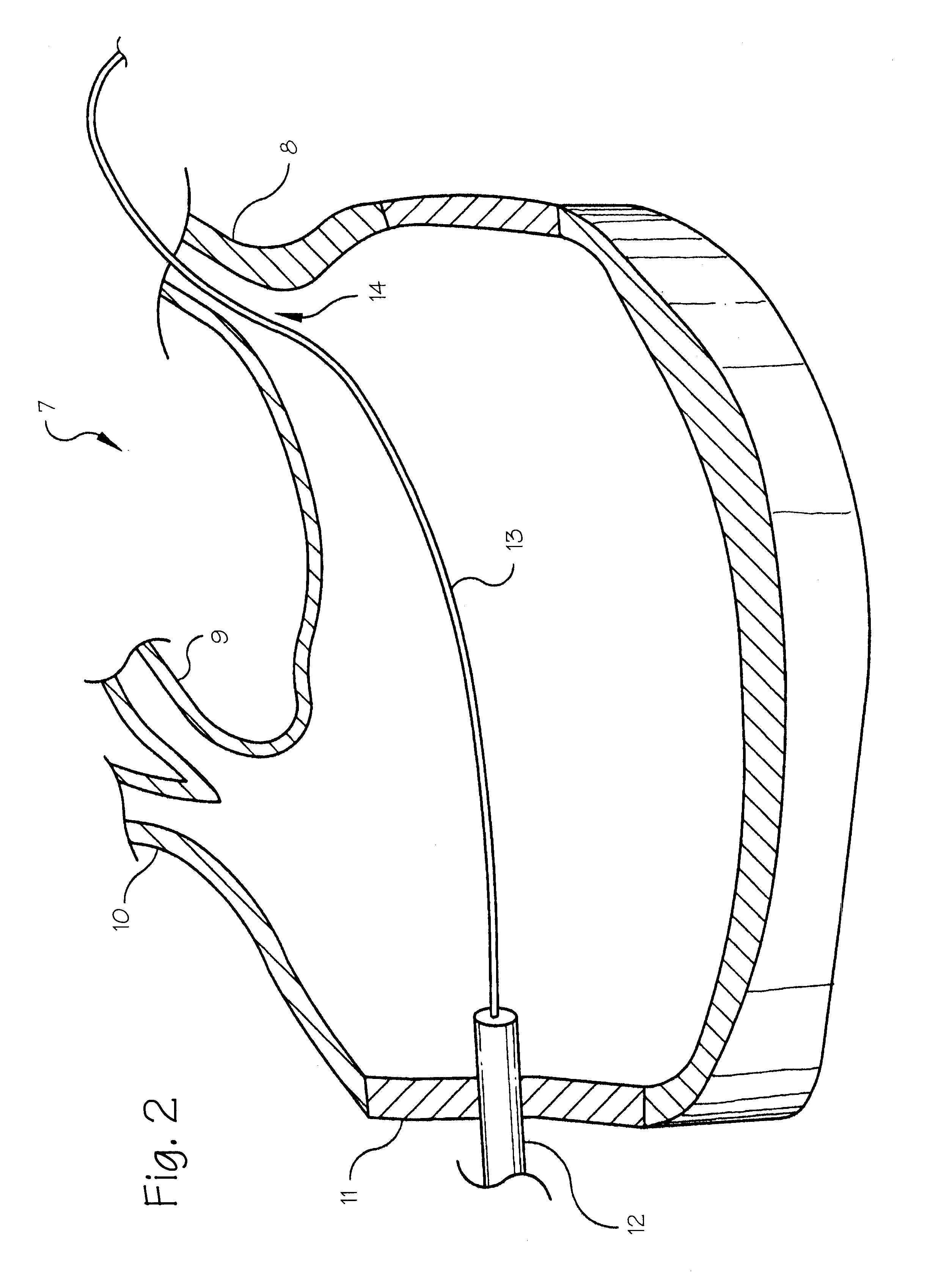 Pulmonary vein arrhythmia diagnostic device and method for use