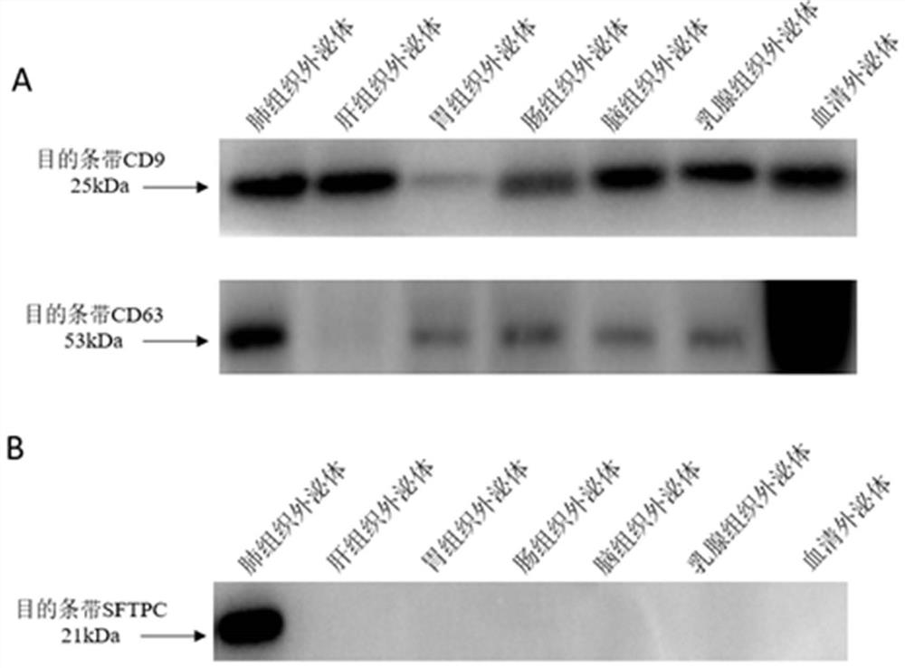 Application and kit of protein sftpc as a diagnostic marker for lung cancer