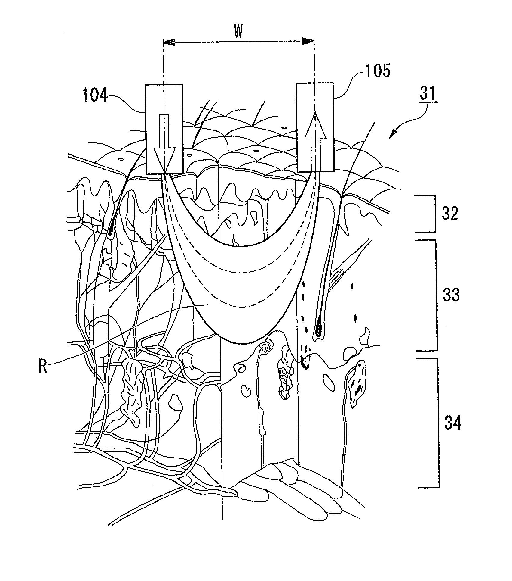 Concentration determination apparatus, concentration determination method, and program