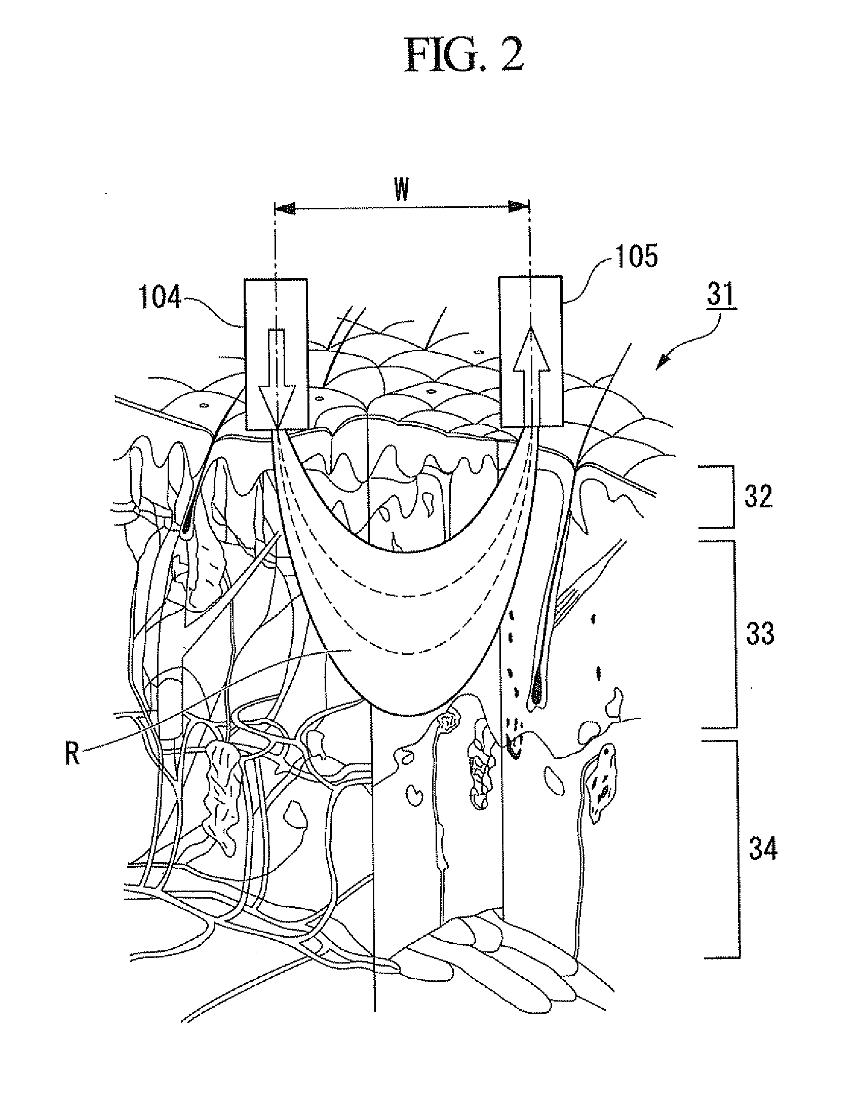 Concentration determination apparatus, concentration determination method, and program