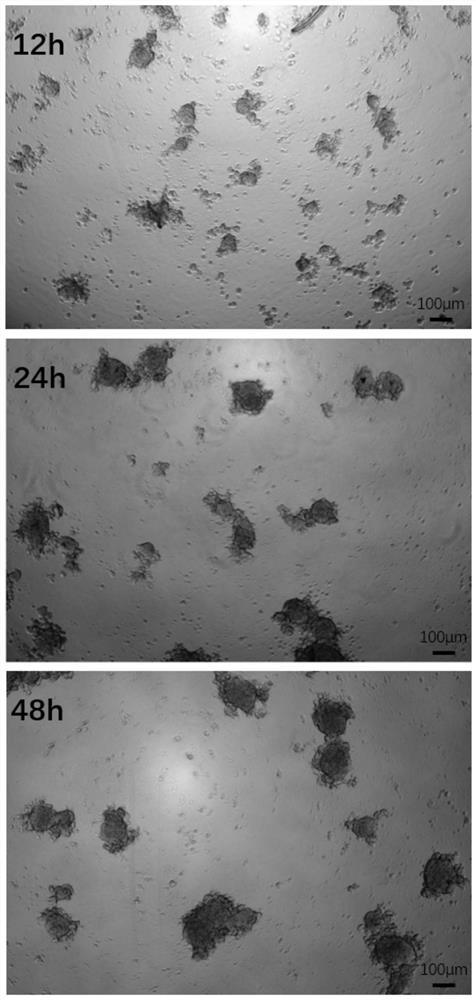 Cryopreservation method, recovery method and reconstruction method of islet cells