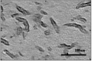 Hydrophilic drug and hydrophobic drug co-loaded target composite nano-drug preparation and preparation method thereof