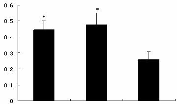 Hydrophilic drug and hydrophobic drug co-loaded target composite nano-drug preparation and preparation method thereof