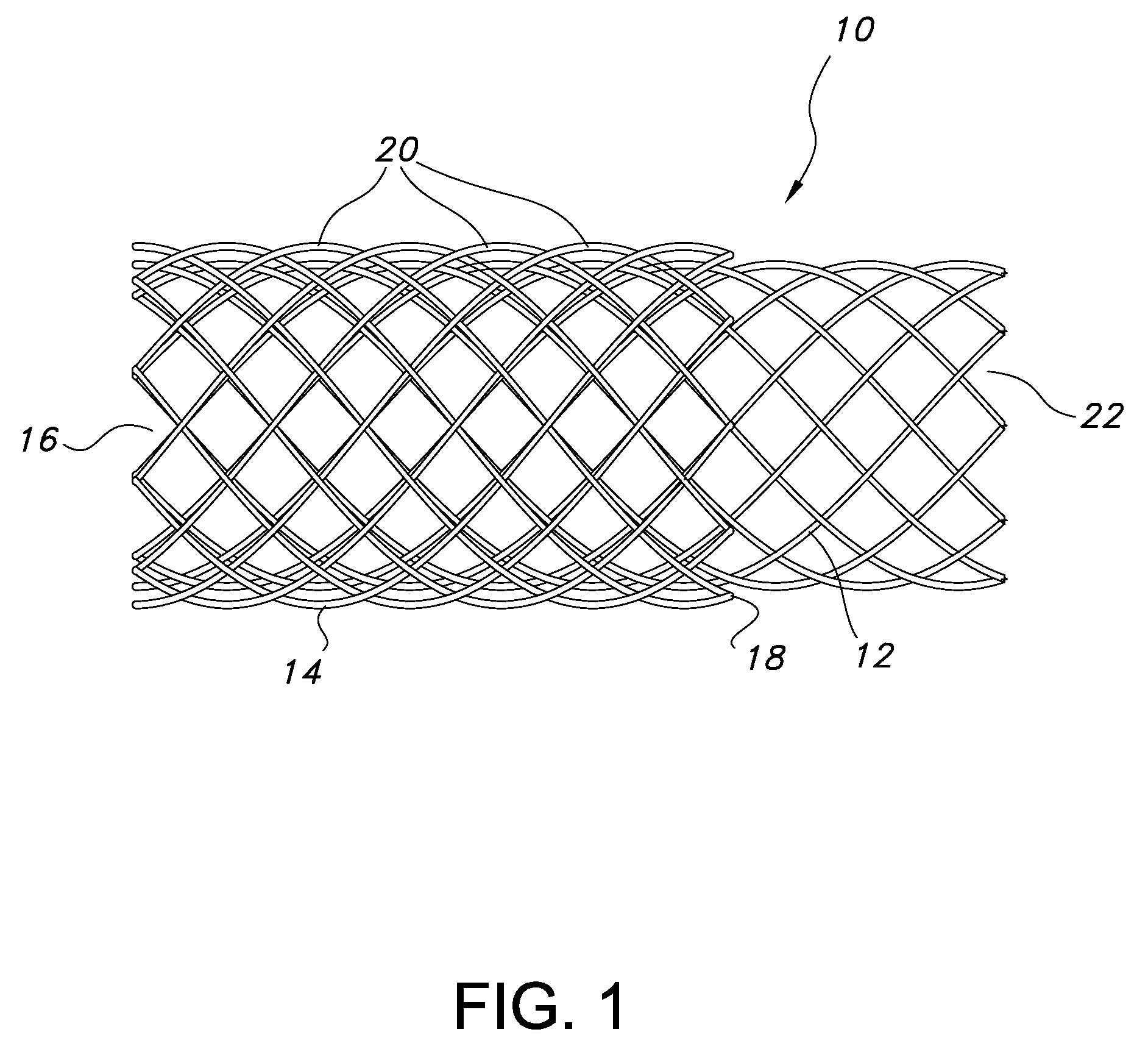 Continuous double layered stent for migration resistance