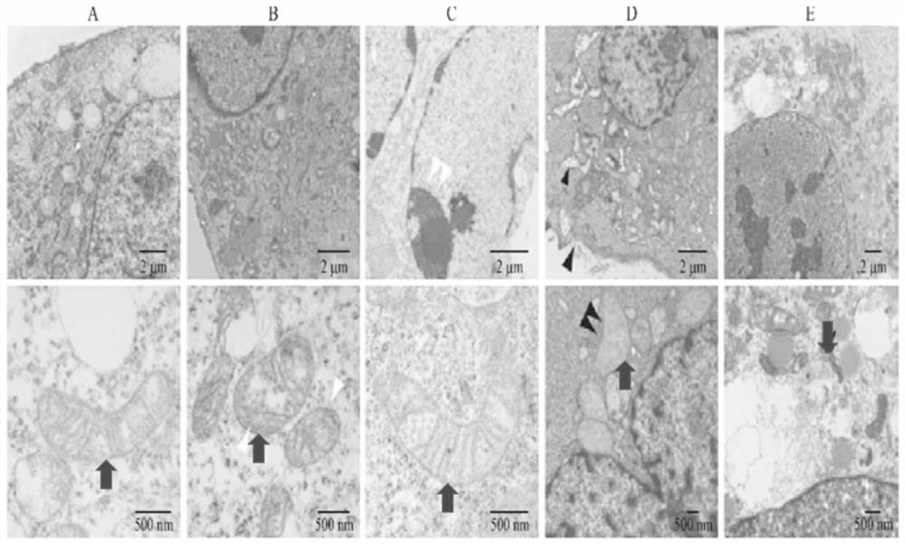 Uses of Ferroptosis Inhibitors