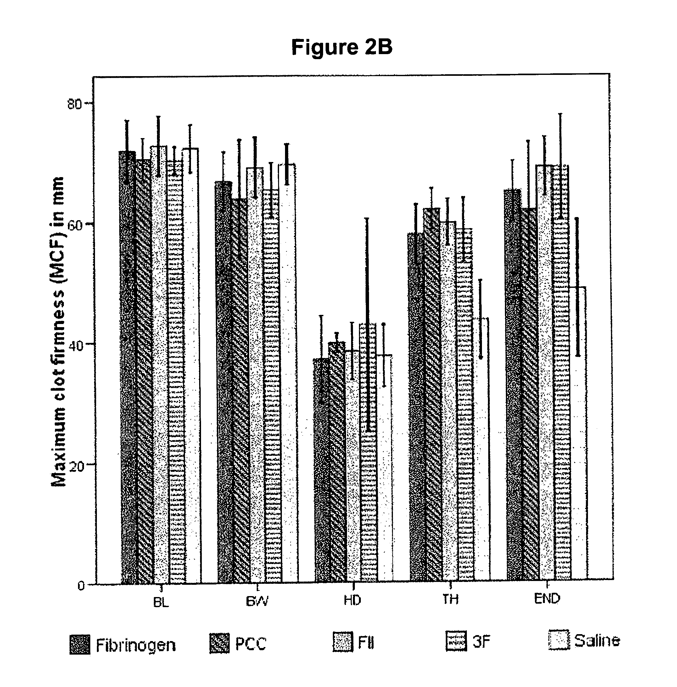 Factor II and fibrinogen for treatment of haemostatic disorders