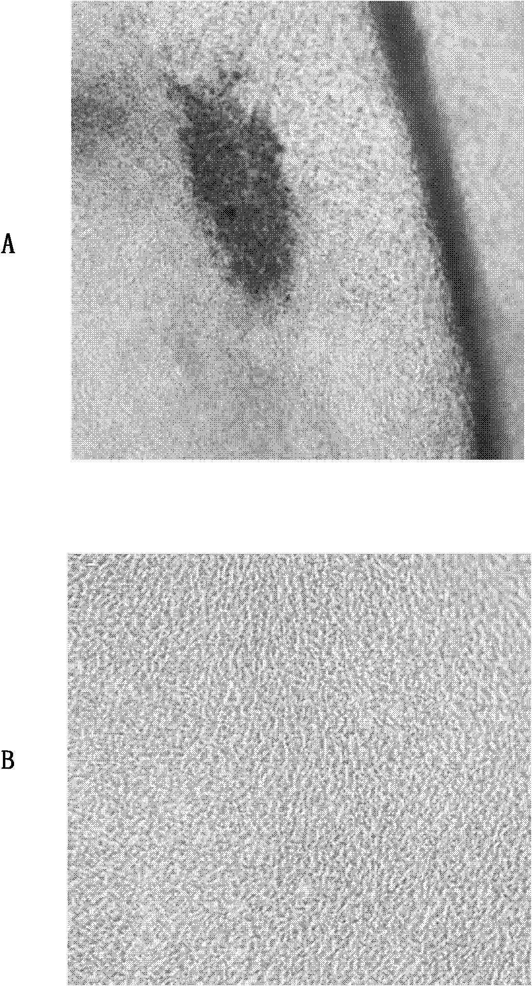 Separating method and application of fat stem cells