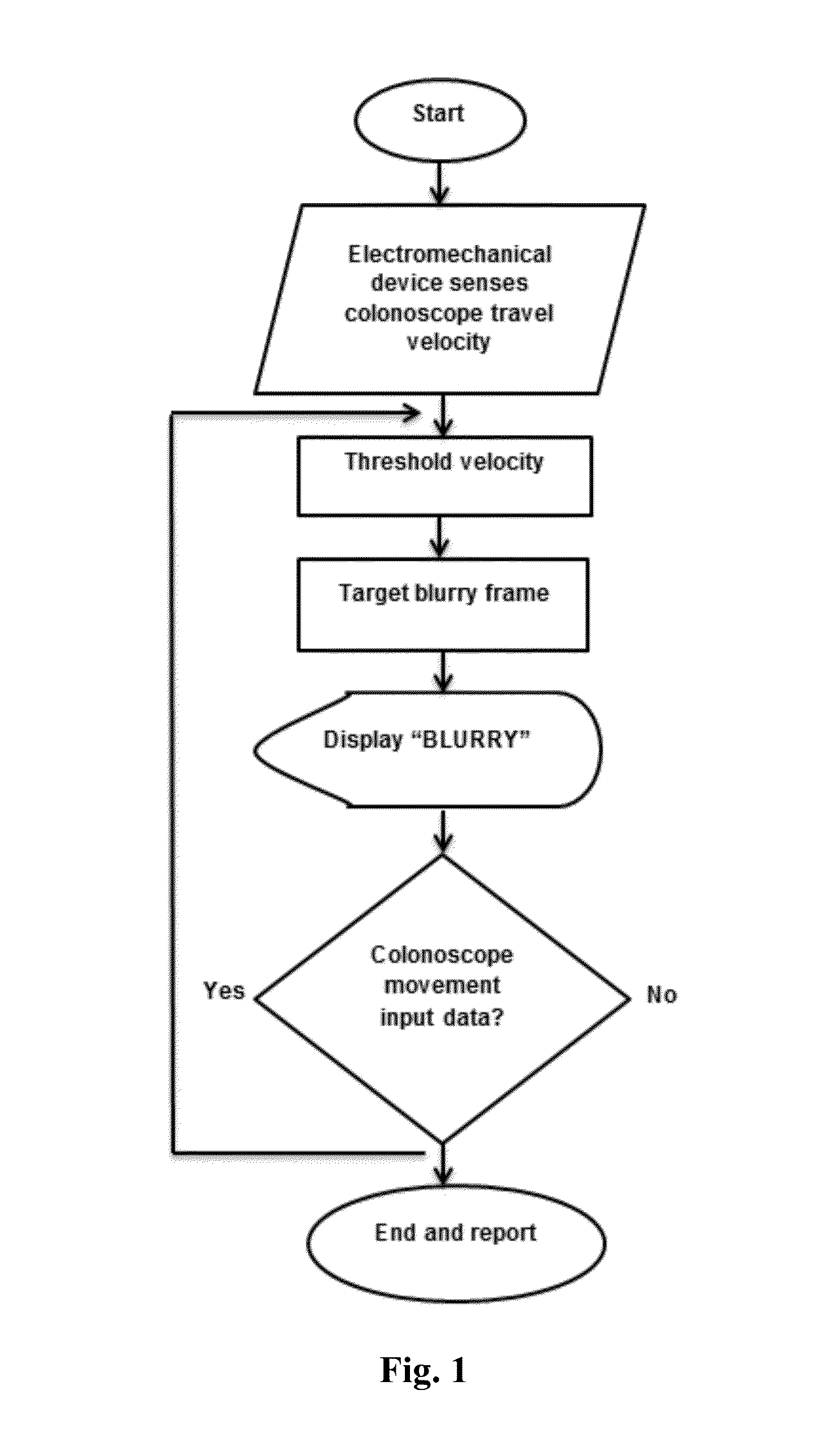 Endoscope Tracking Device