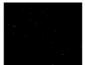 Preparation method of medical porous metal implant material