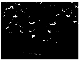 Preparation method of medical porous metal implant material