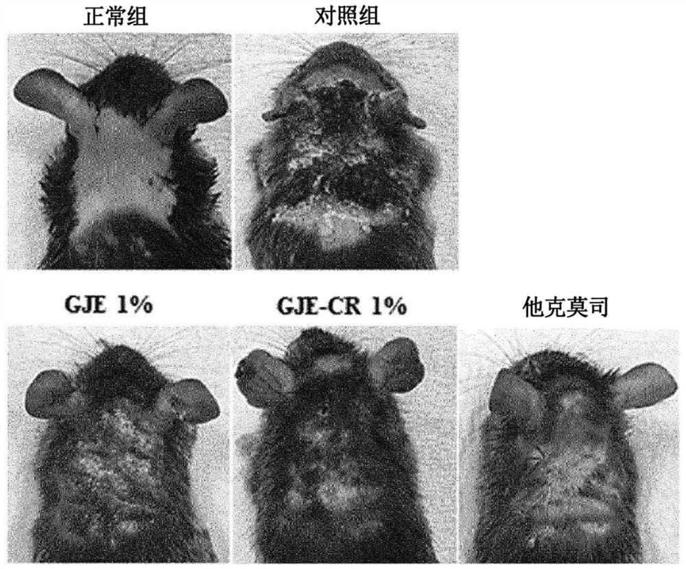 Composition for preventing, alleviating or treating allergic skin diseases, containing, as active ingredient, extract of gardenia fruits from which pigments are removed