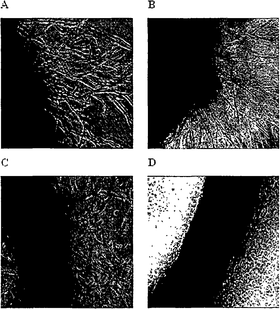 Application of gambogicacid in preparing medication for restraining angiogenesis