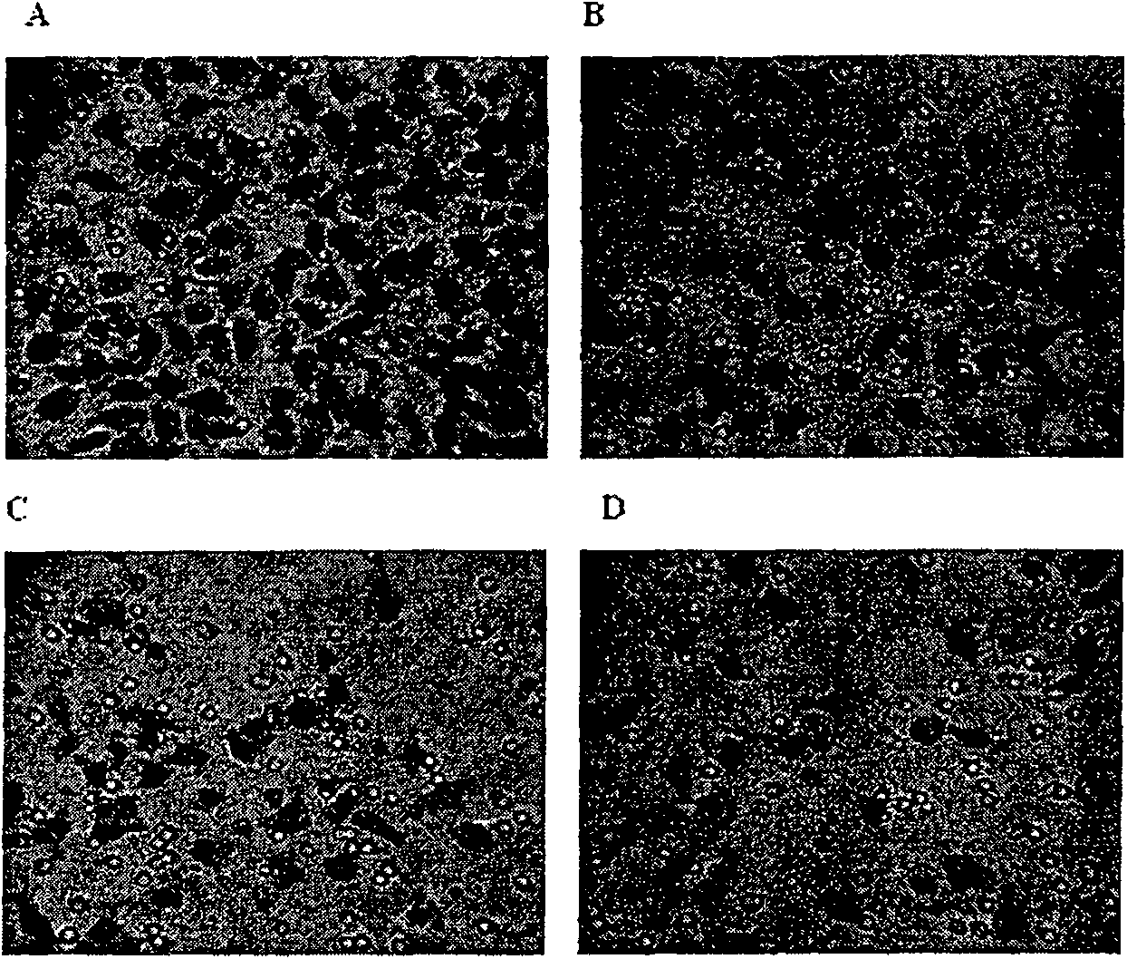 Application of gambogicacid in preparing medication for restraining angiogenesis