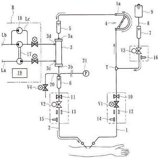 blood purification device