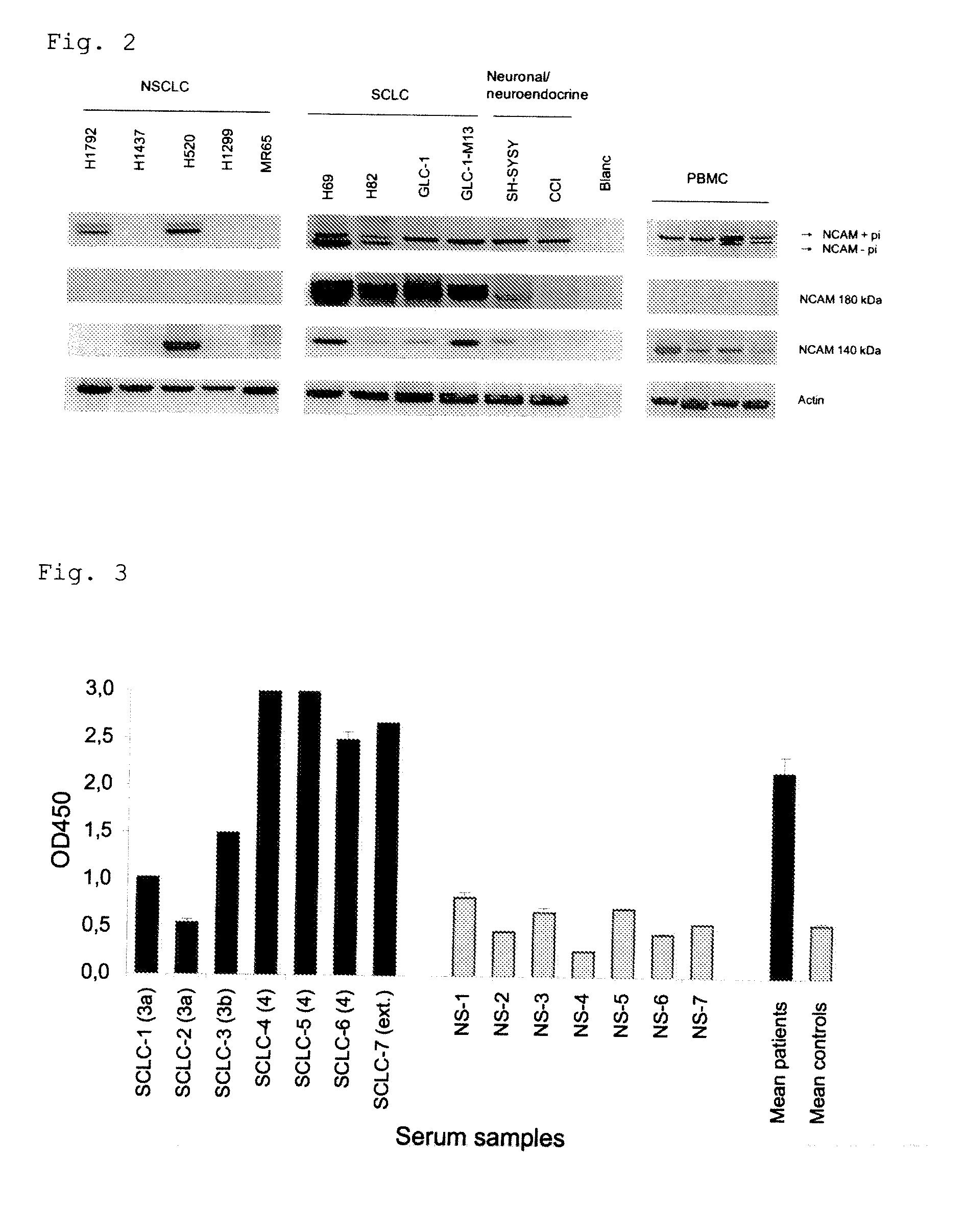 Small cell lung carcinoma biomarker panel