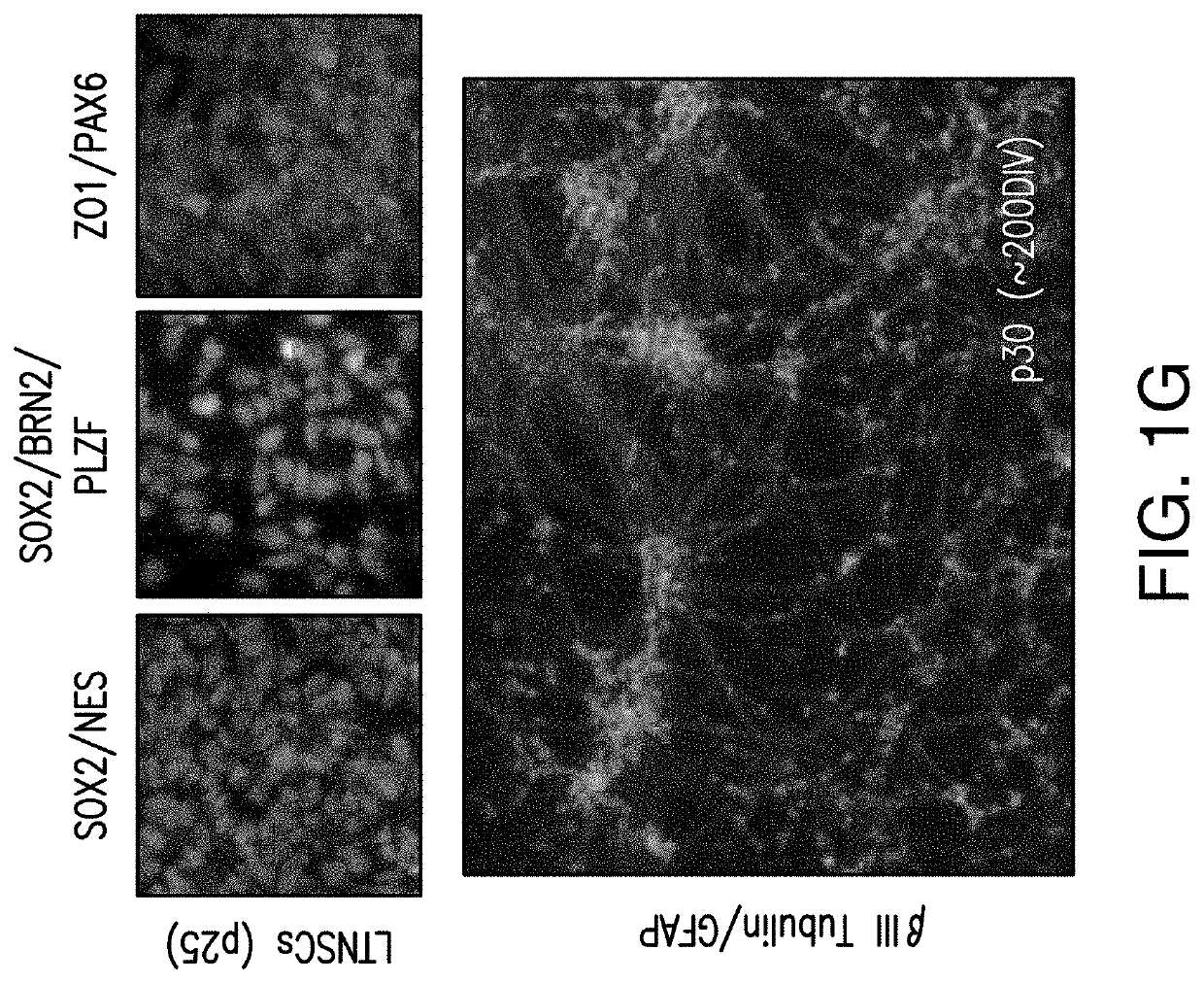 Stem cell-derived astrocytes, methods of making and methods of use