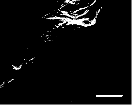 High-simulation tissue engineering nerve-repair material and preparation method