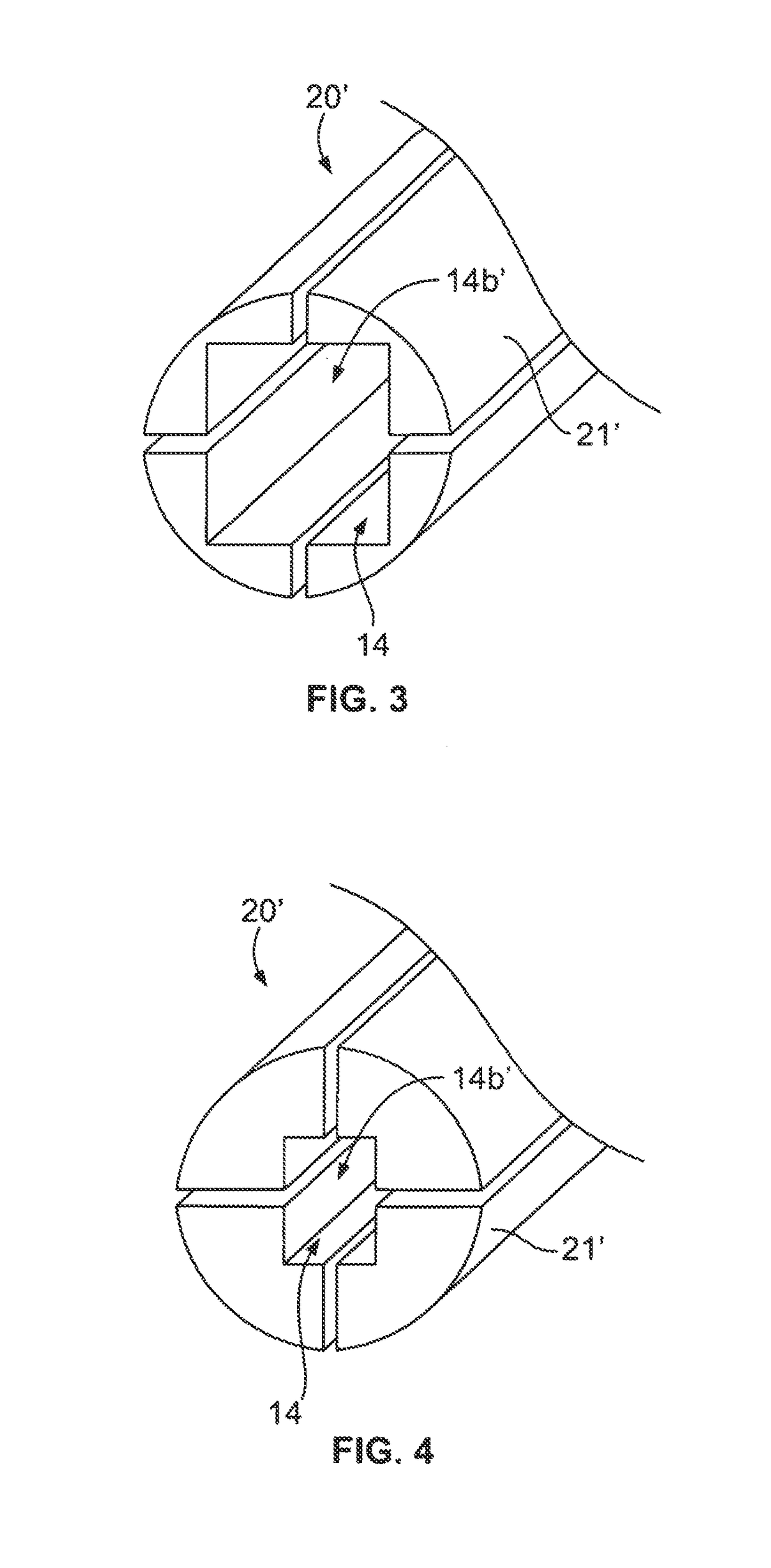 Configurable intervertebral implant