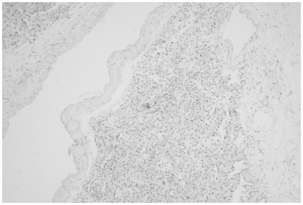 Immunohistochemical combined elastic fiber multi-staining kit, staining method and application