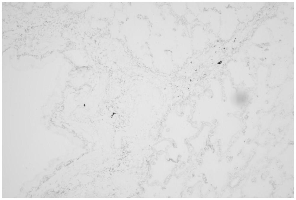 Immunohistochemical combined elastic fiber multi-staining kit, staining method and application